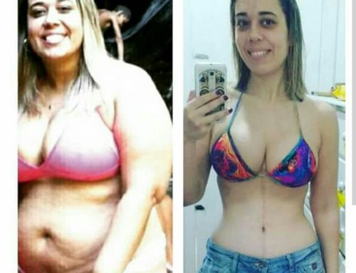 Antes e depois – Fernanda Baptista
